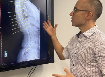 Why do Chiropractor’s take x-rays?