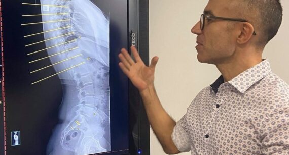 Why do Chiropractor’s take x-rays?